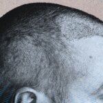 Does Creatine Cause Hair Loss?