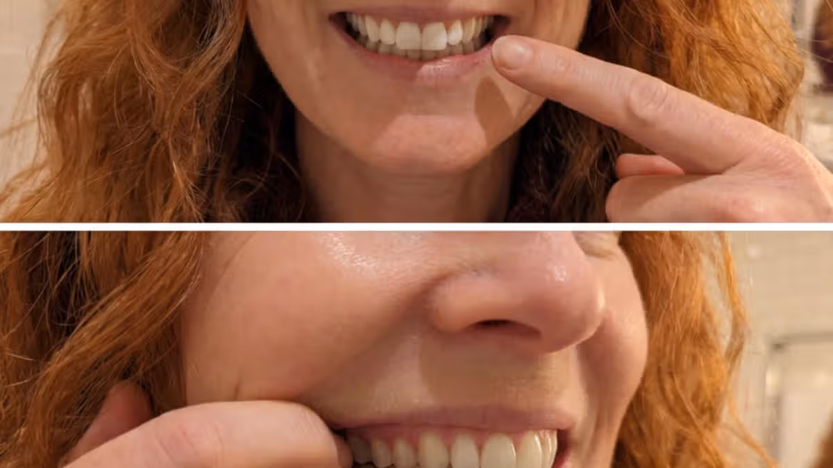 Mum’s gums ‘bled for 11 years’ after kids were born until she used 32p-a-go serum
