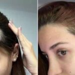 Woman ‘no longer embarrassed’ by thinning hair after using £29 serum for 3 months