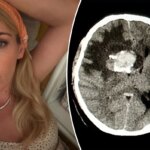 What is oligodendroglioma? Busy Philipps’ brain tumor explained