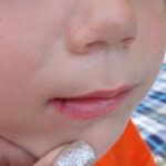 Furious mum demands Aldi pull toy after son left bloodied at birthday party