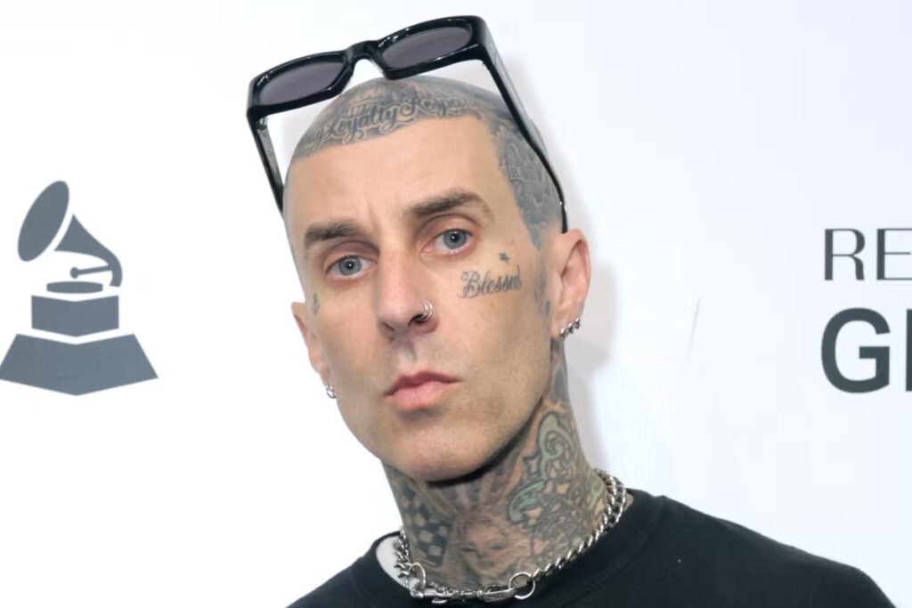 Travis Barker shares harrowing new details about 2008 plane crash: ‘65% of my body was burned’