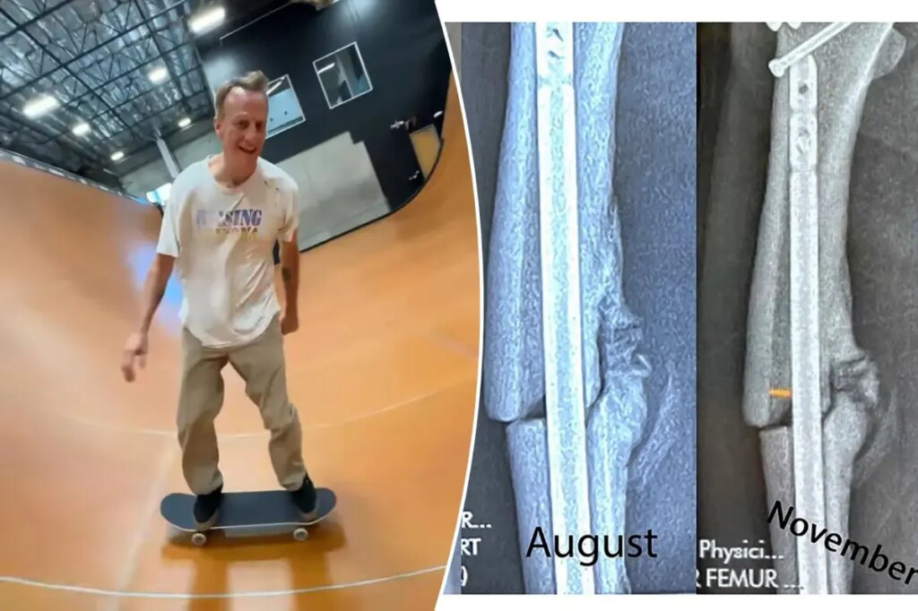 Tony Hawk: The brutal injury that taught me an important lesson