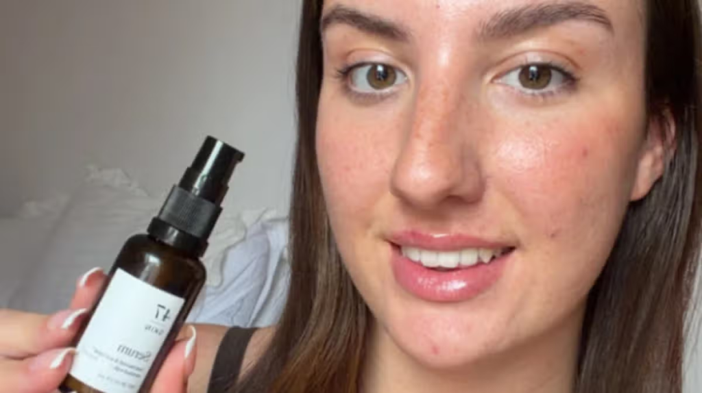 Bride who ‘cleared spots’ for wedding with 77p-a-day serum says ‘skin is amazing’