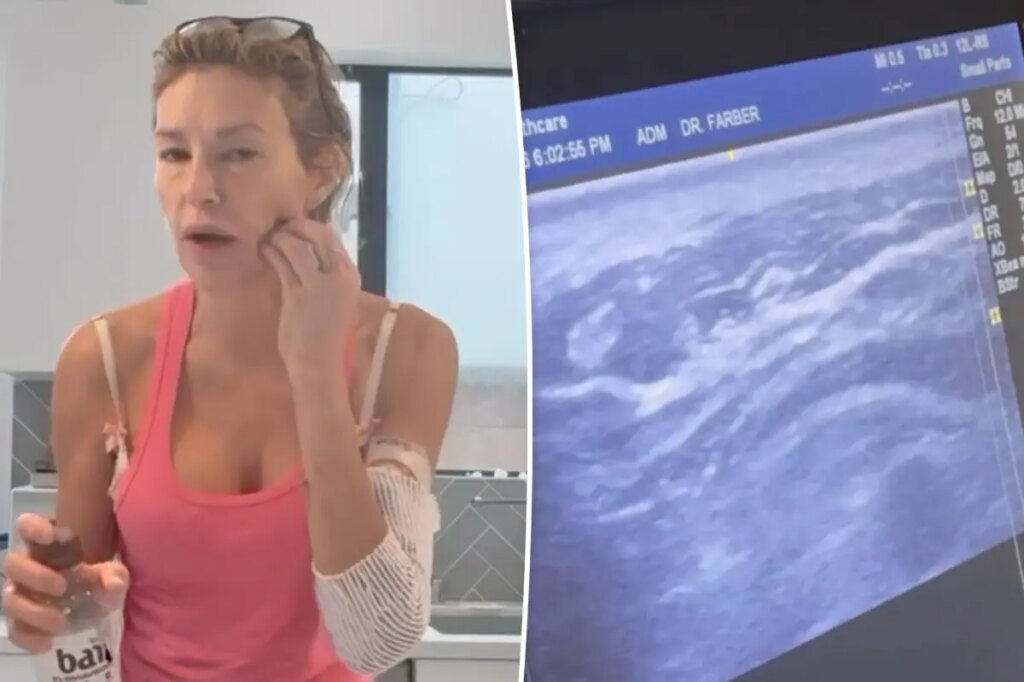 Brandi Glanville saw ‘something alive’ and ‘moving’ in her face in horrifying ultrasound