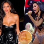 Nicole Scherzinger shows off gruesome injury after ‘boiling water’ fell on her leg 1 hour before concert
