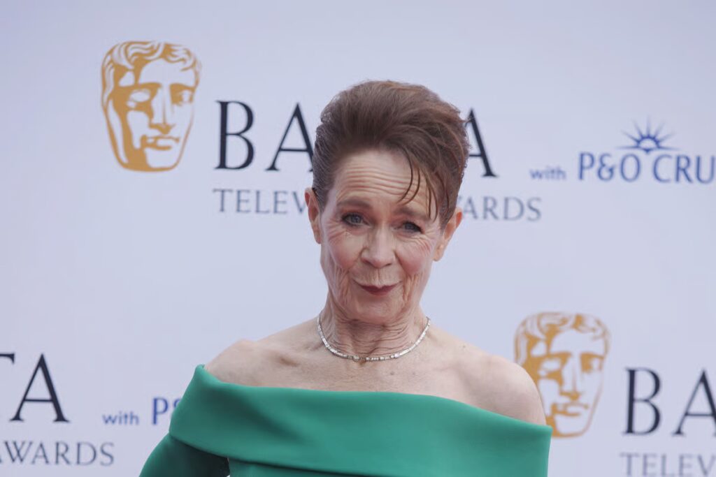 Celia Imrie says treatment for anorexia as a teenager was ‘horrible time’