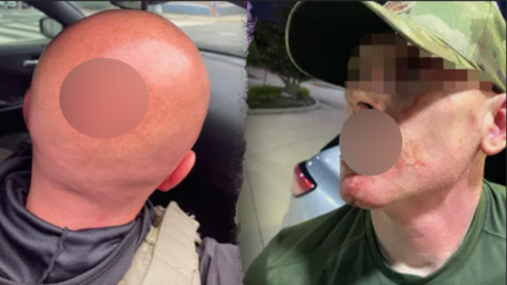 ICE officer assaults surge 1,649% since Trump crackdown, DHS says
