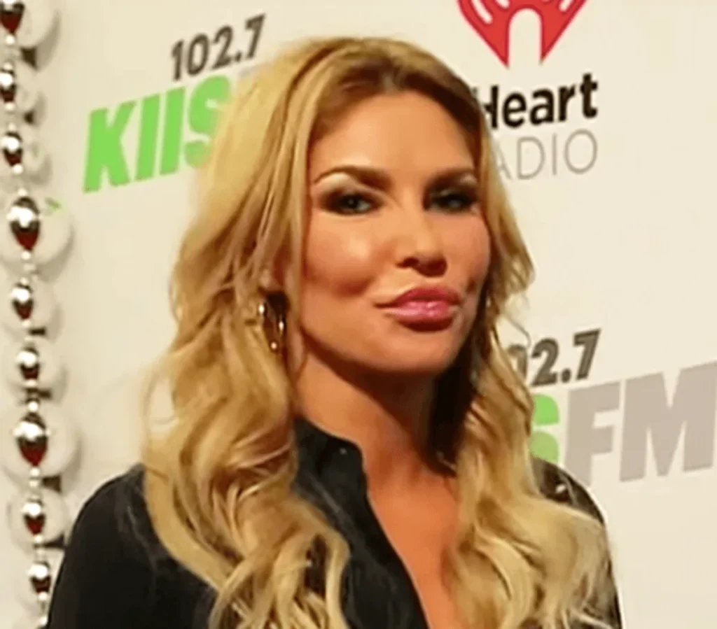 Brandi Glanville Says There Is ‘Something Alive’ in Her Face That She Will Cut Out if Doctors Won’t