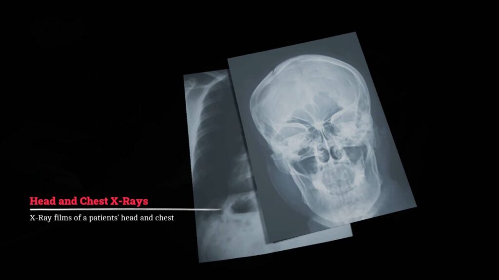 Silent Hill Townfall X-Ray puzzle solution