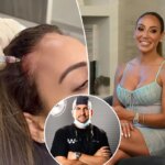 How I restored Melissa Gorga’s thinning hair