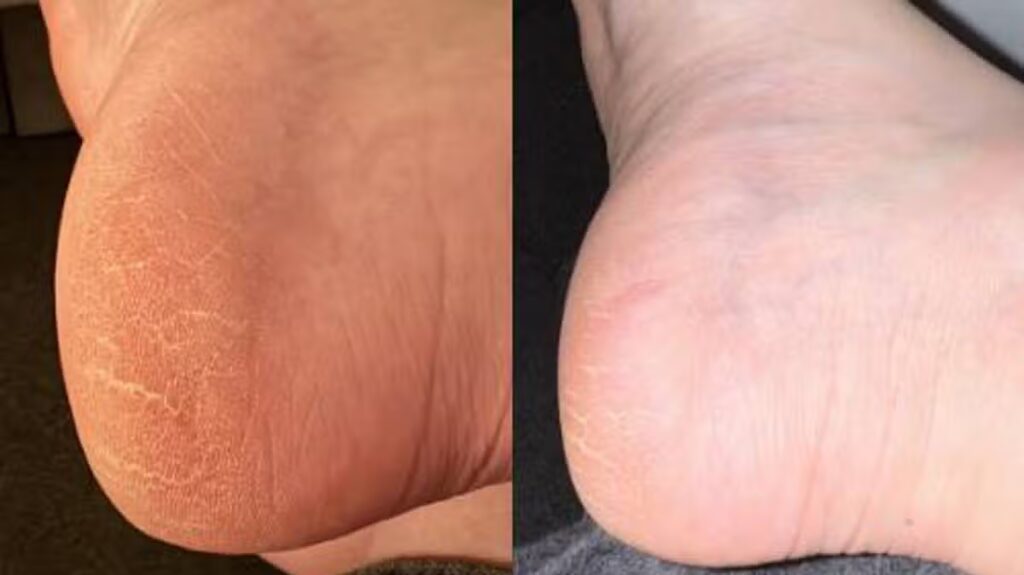 Women swap £40 pedicures for £12 scrub leaving ‘feet and legs incredibly soft’
