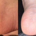 Women swap £40 pedicures for £12 scrub leaving ‘feet and legs incredibly soft’