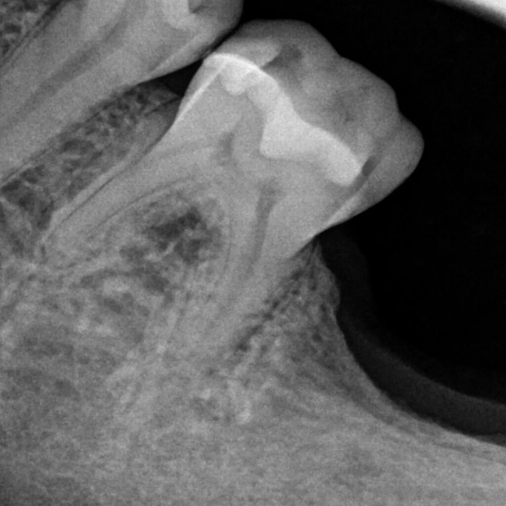 Shane Parish Surprise Releases New Album ‘Dental Work’ To Pay For His Dental Work