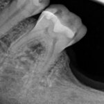 Shane Parish Surprise Releases New Album ‘Dental Work’ To Pay For His Dental Work
