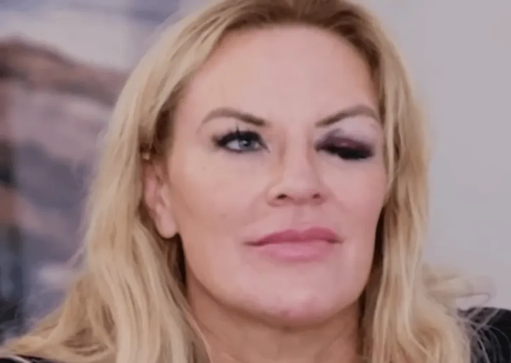 Former Bravo Producer Said Heather Gay’s Black Eye Lie Is the Most ‘Reckless’ Thing a Housewife Has Ever Done 